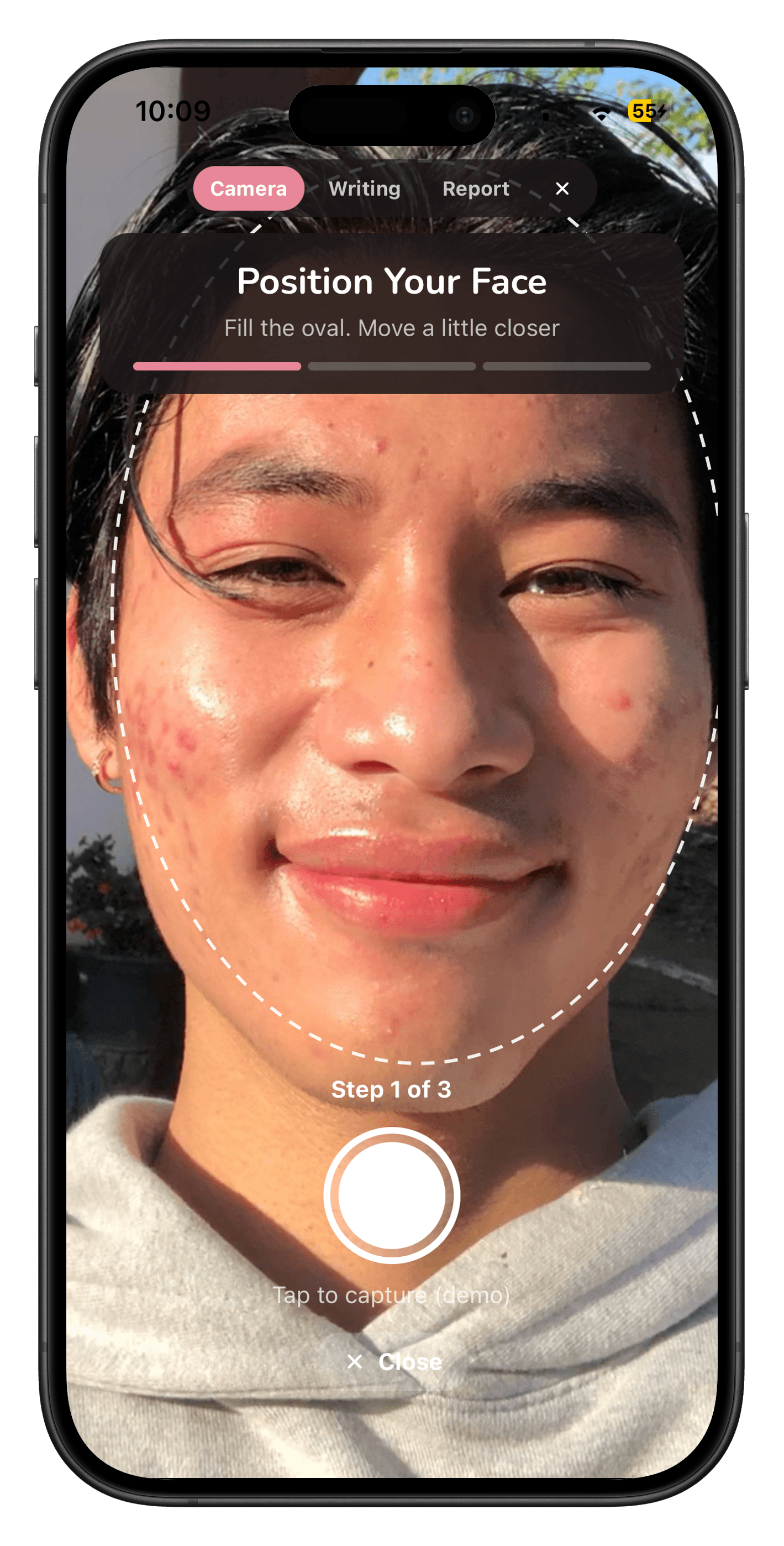SkinStory check-in camera, lining up a weekly face photo