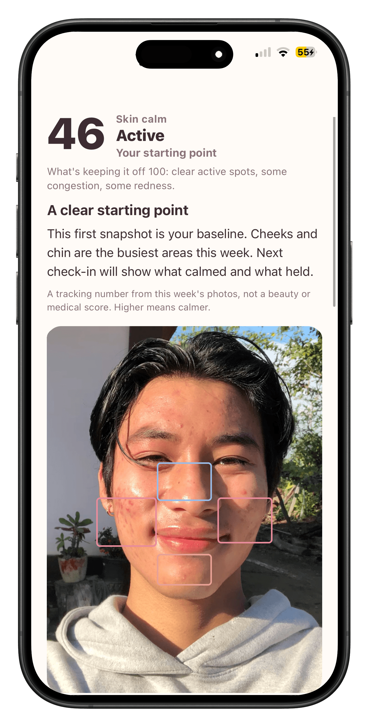 SkinStory weekly acne diary check-in on iPhone