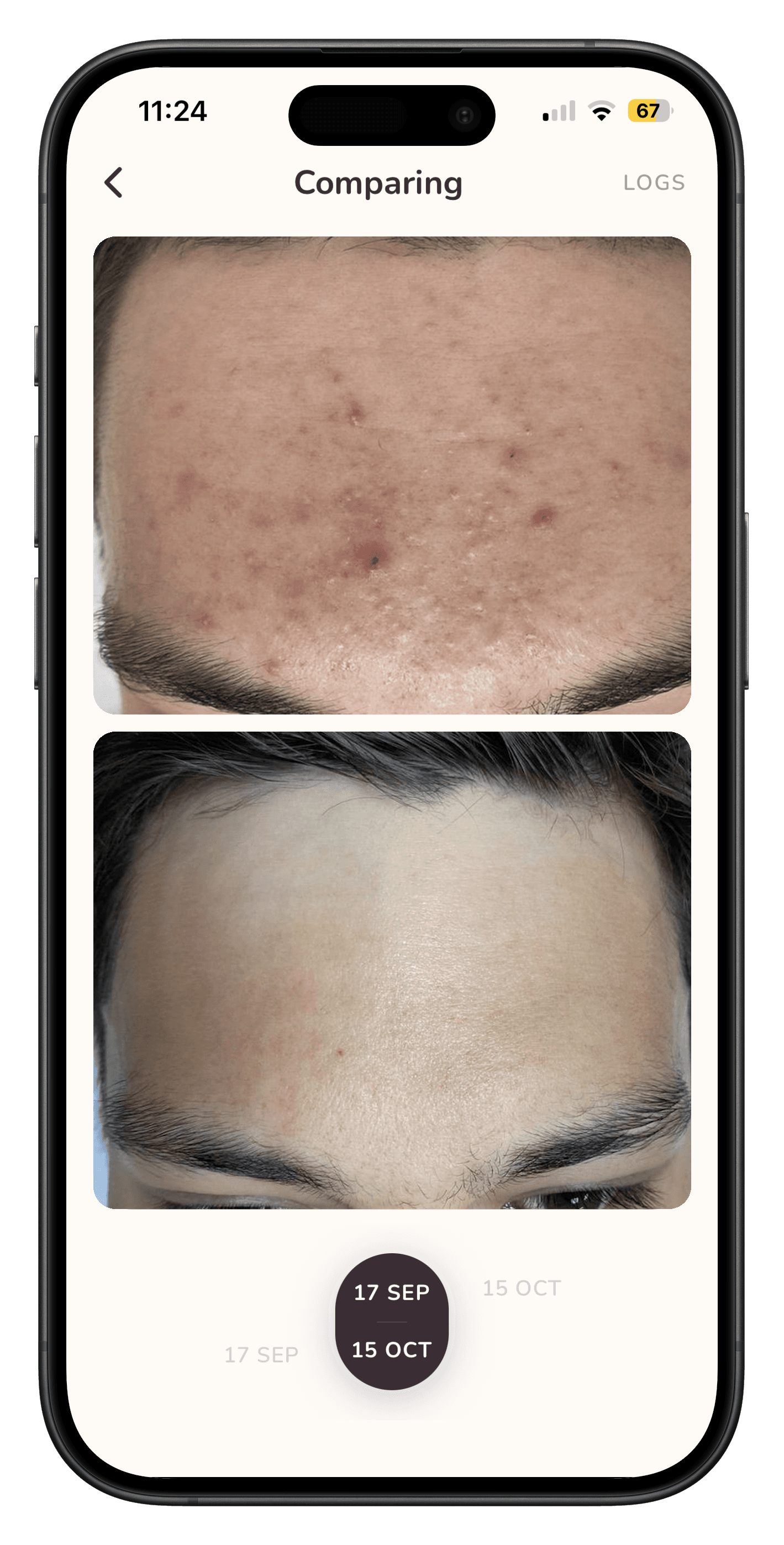 SkinStory comparing two weekly photos, an earlier week beside a later one